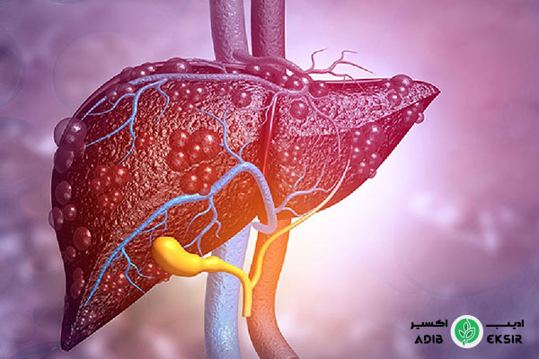 کبد چرب درمان